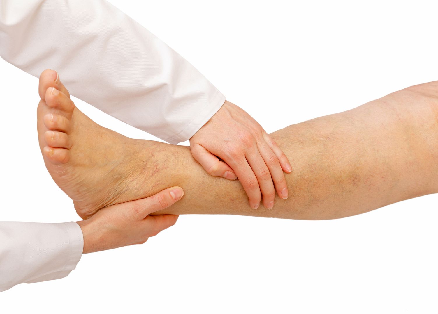 Effects of leg edema in pregnancy